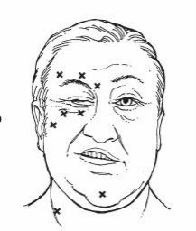 眼眶病,?，斎鹨曆劭?上海眼科醫(yī)院