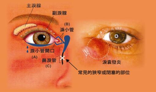 眼眶病,?，斎鹨曆劭?上海眼科醫(yī)院