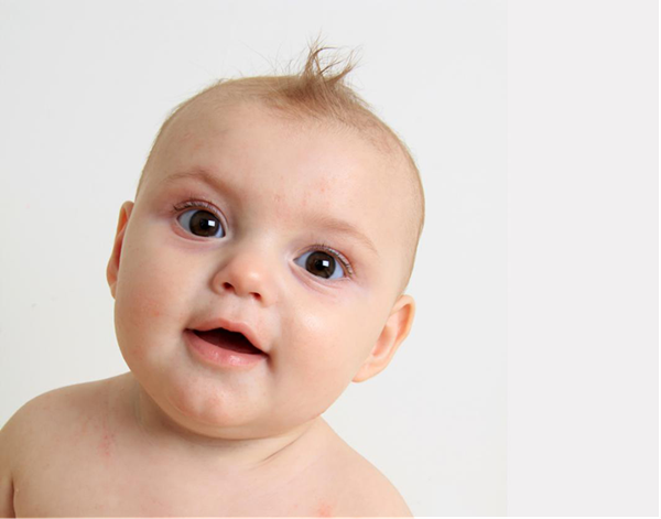 青光眼,?，斎鹨曆劭?上海眼科醫(yī)院