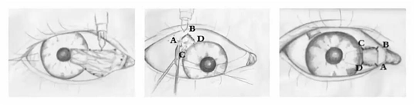 眼表眼角膜,?，斎鹨曆劭?上海眼科醫(yī)院