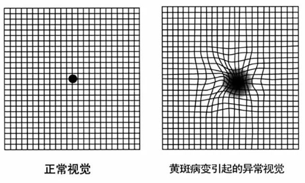 玻璃體視網(wǎng)膜,?，斎鹨曆劭?上海眼科醫(yī)院