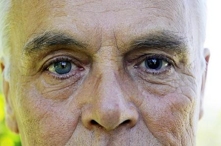 白內(nèi)障,?，斎鹨曆劭?上海眼科醫(yī)院