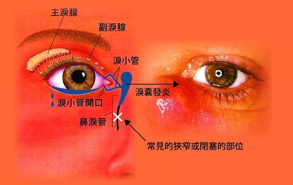 眼眶病,?，斎鹨曆劭?上海眼科醫(yī)院