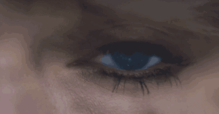 青光眼,?，斎鹨曆劭?上海眼科醫(yī)院