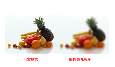 小兒眼病,?，斎鹨曆劭?上海眼科醫(yī)院