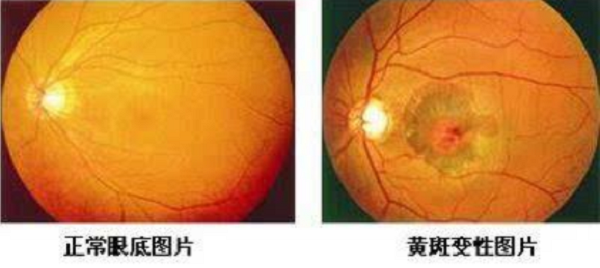 眼表眼角膜,?，斎鹨曆劭?上海眼科醫(yī)院