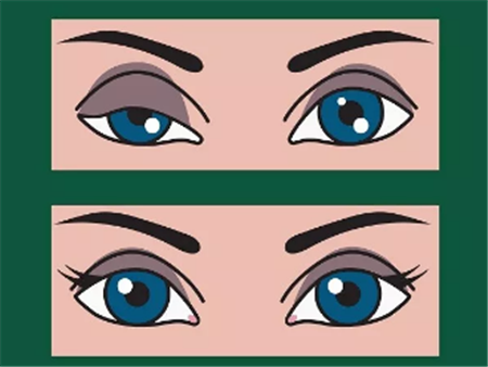 眼眶病,希瑪瑞視眼科,上海眼科醫(yī)院