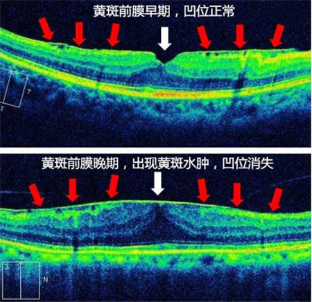 玻璃體視網(wǎng)膜,希瑪瑞視眼科,上海眼科醫(yī)院