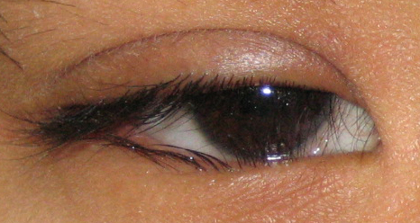 眼眶病,?，斎鹨曆劭?上海眼科醫(yī)院