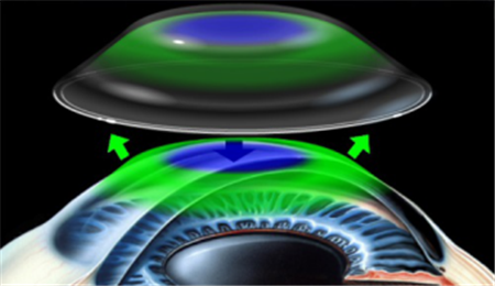 小兒眼病,?，斎鹨曆劭?上海眼科醫(yī)院