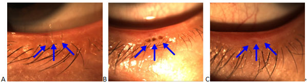 眼眶病,希瑪瑞視眼科,上海眼科醫(yī)院