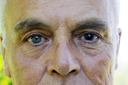 白內(nèi)障,希瑪瑞視眼科,上海眼科醫(yī)院