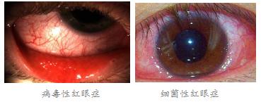 眼表眼角膜,希瑪瑞視眼科,上海眼科醫(yī)院