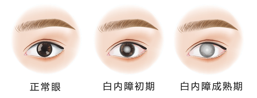 醫(yī)學(xué)驗(yàn)光配鏡,?，斎鹨曆劭?上海眼科醫(yī)院