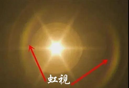 青光眼,?，斎鹨曆劭?上海眼科醫(yī)院