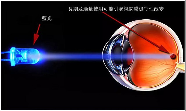 屈光矯視,?，斎鹨曆劭?上海眼科醫(yī)院