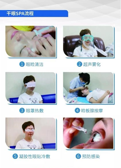 眼表眼角膜,?，斎鹨曆劭?上海眼科醫(yī)院