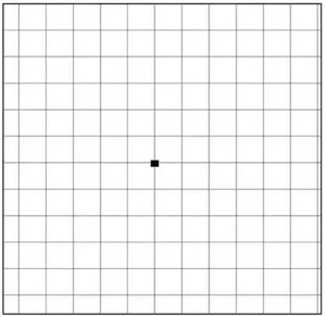 玻璃體視網(wǎng)膜,?，斎鹨曆劭?上海眼科醫(yī)院