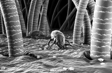 眼表眼角膜,希瑪瑞視眼科,上海眼科醫(yī)院