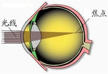 屈光矯視,?，斎鹨曆劭?上海眼科醫(yī)院