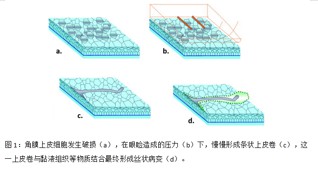 眼表眼角膜,?，斎鹨曆劭?上海眼科醫(yī)院