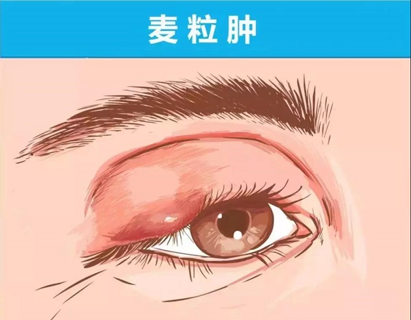 眼表眼角膜,?，斎鹨曆劭?上海眼科醫(yī)院