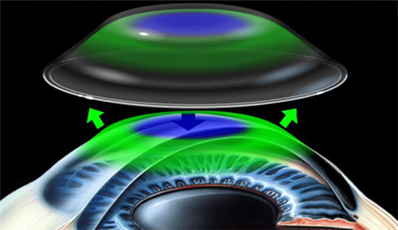 小兒眼病,?，斎鹨曆劭?上海眼科醫(yī)院