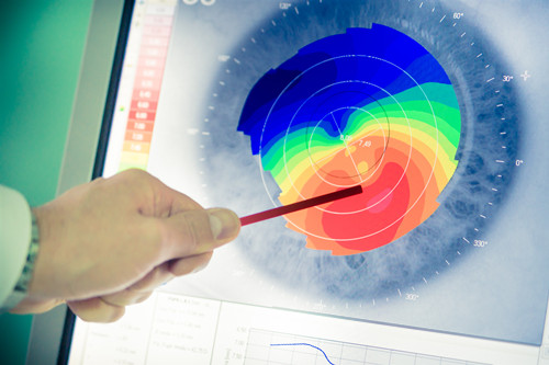 眼表眼角膜,?,斎鹨曆劭?上海眼科醫(yī)院 眼表眼角膜,希瑪瑞視眼科,上海眼科醫(yī)院
