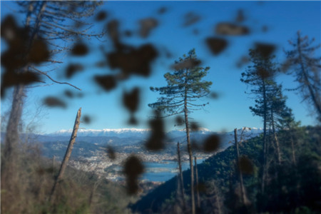 玻璃體視網(wǎng)膜,?，斎鹨曆劭?上海眼科醫(yī)院