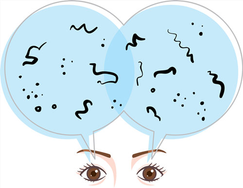 玻璃體視網(wǎng)膜,?，斎鹨曆劭?上海眼科醫(yī)院