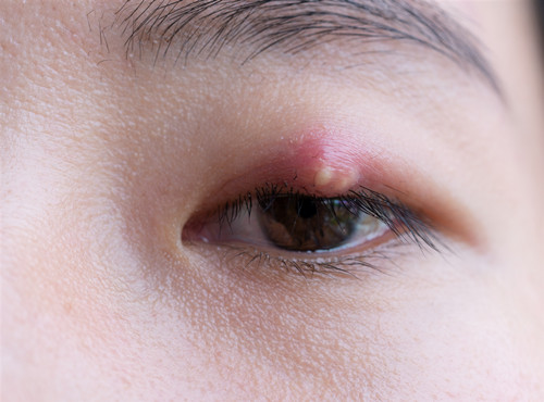 眼表眼角膜,?，斎鹨曆劭?上海眼科醫(yī)院