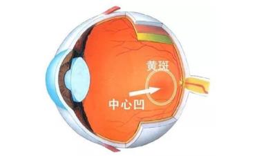 玻璃體視網(wǎng)膜,?，斎鹨曆劭?上海眼科醫(yī)院