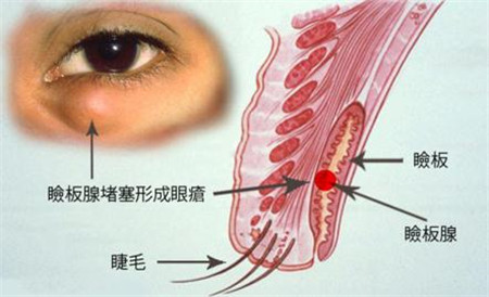 眼表眼角膜,?，斎鹨曆劭?上海眼科醫(yī)院
