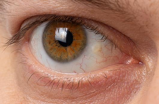 眼表眼角膜,希瑪瑞視眼科,上海眼科醫(yī)院