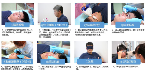 眼表眼角膜,?，斎鹨曆劭?上海眼科醫(yī)院